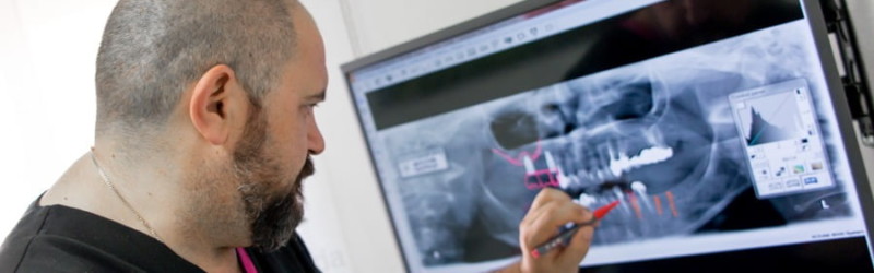 Novedosos sistemas para conseguir la sonrisa que deseas