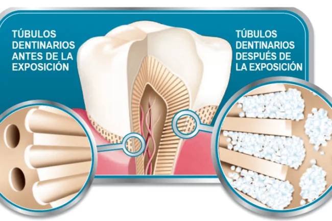láser dental