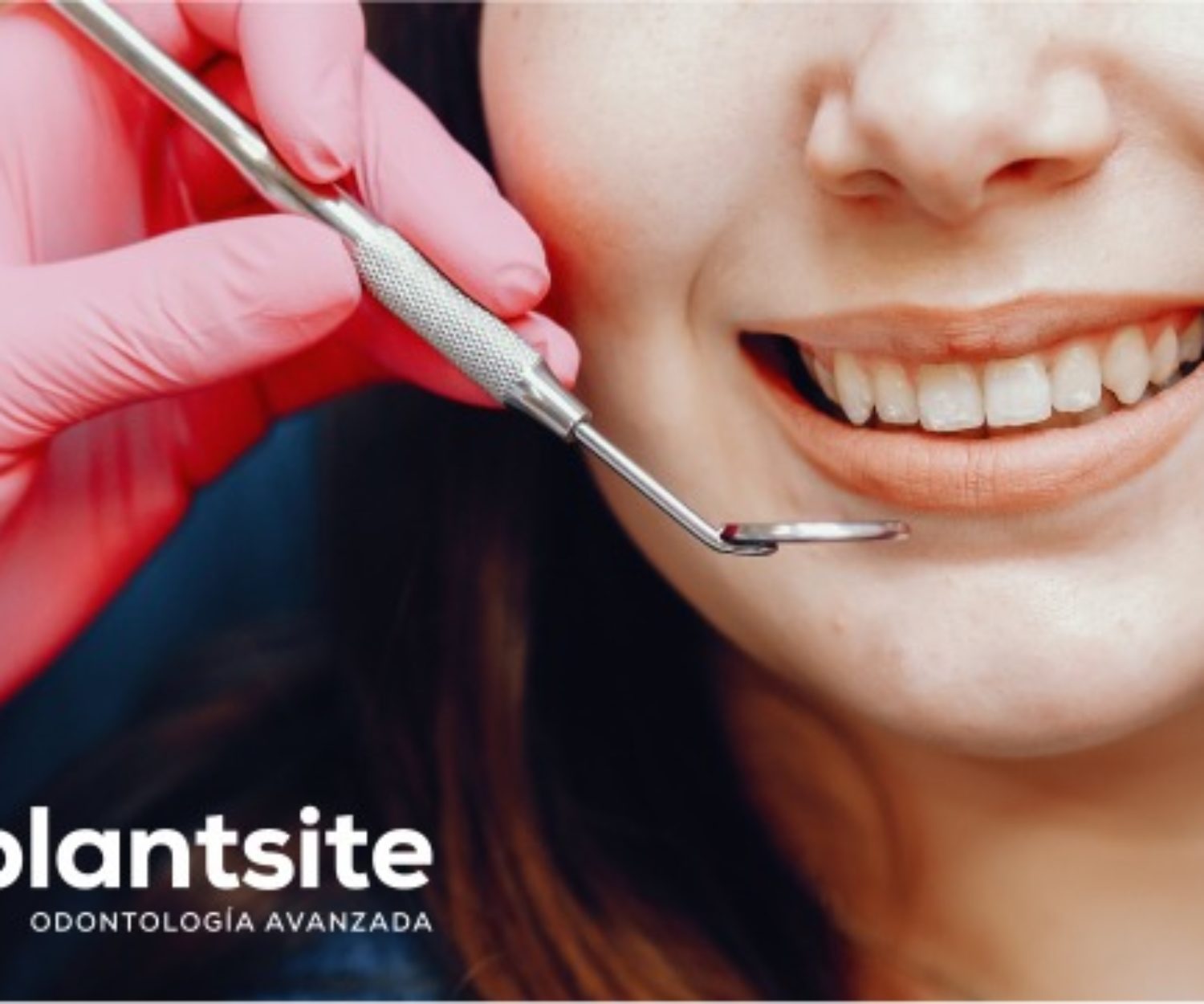 Claves de la limpieza dental. Somos expertos en limpieza dental en Dos Hermanas