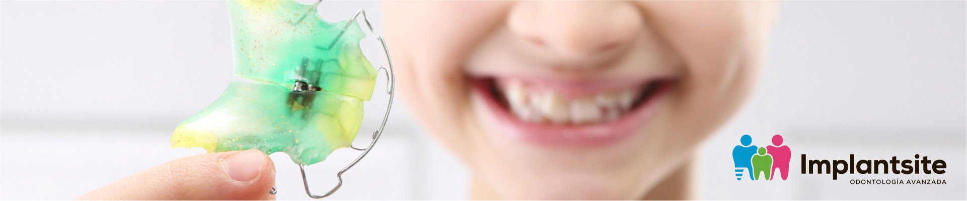 aparato dental brackets infantiles