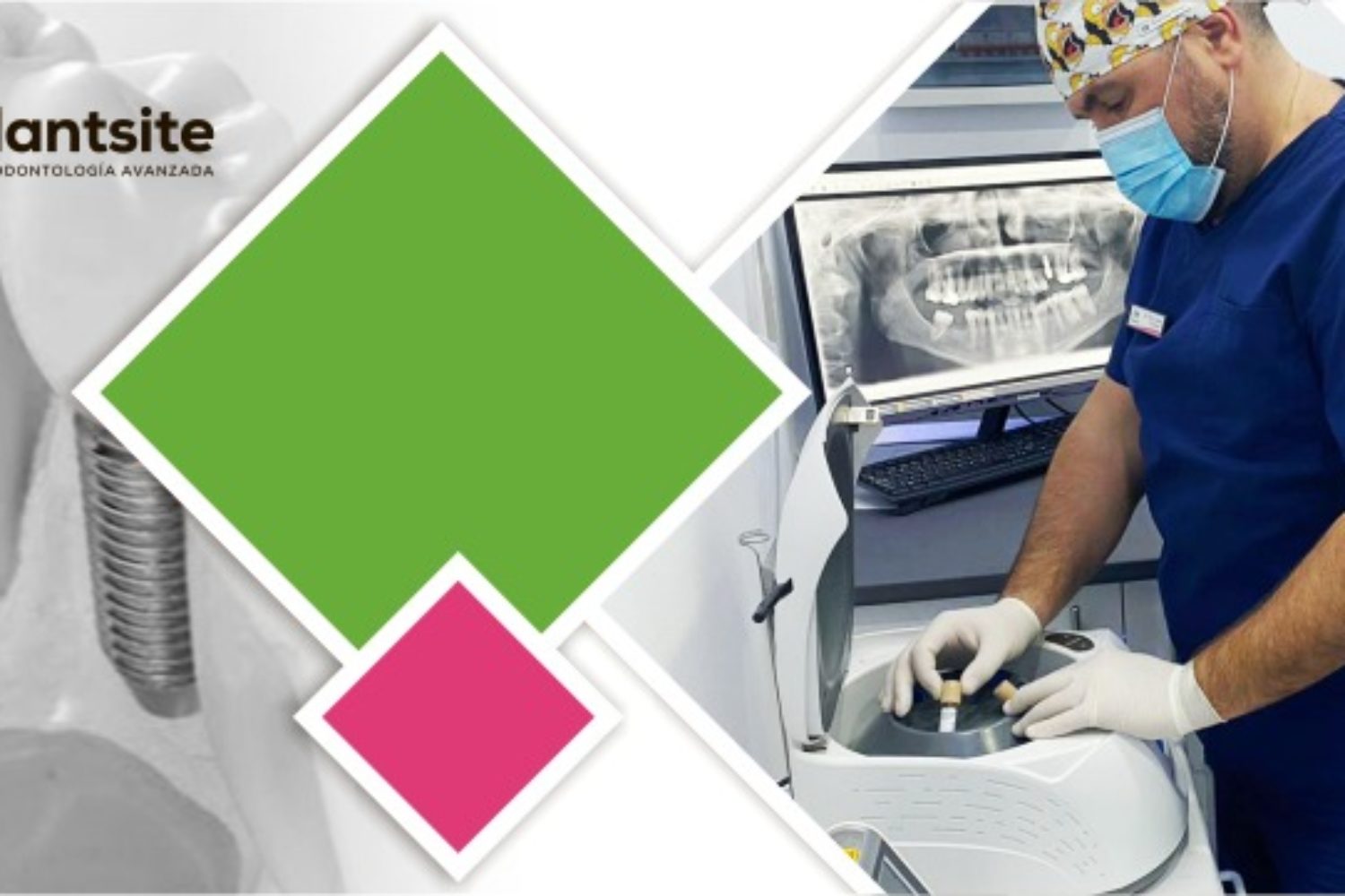 doctor de Clínica Implantsite utilizando la centrifugadora de plasma para la regeneración ósea de un paciente