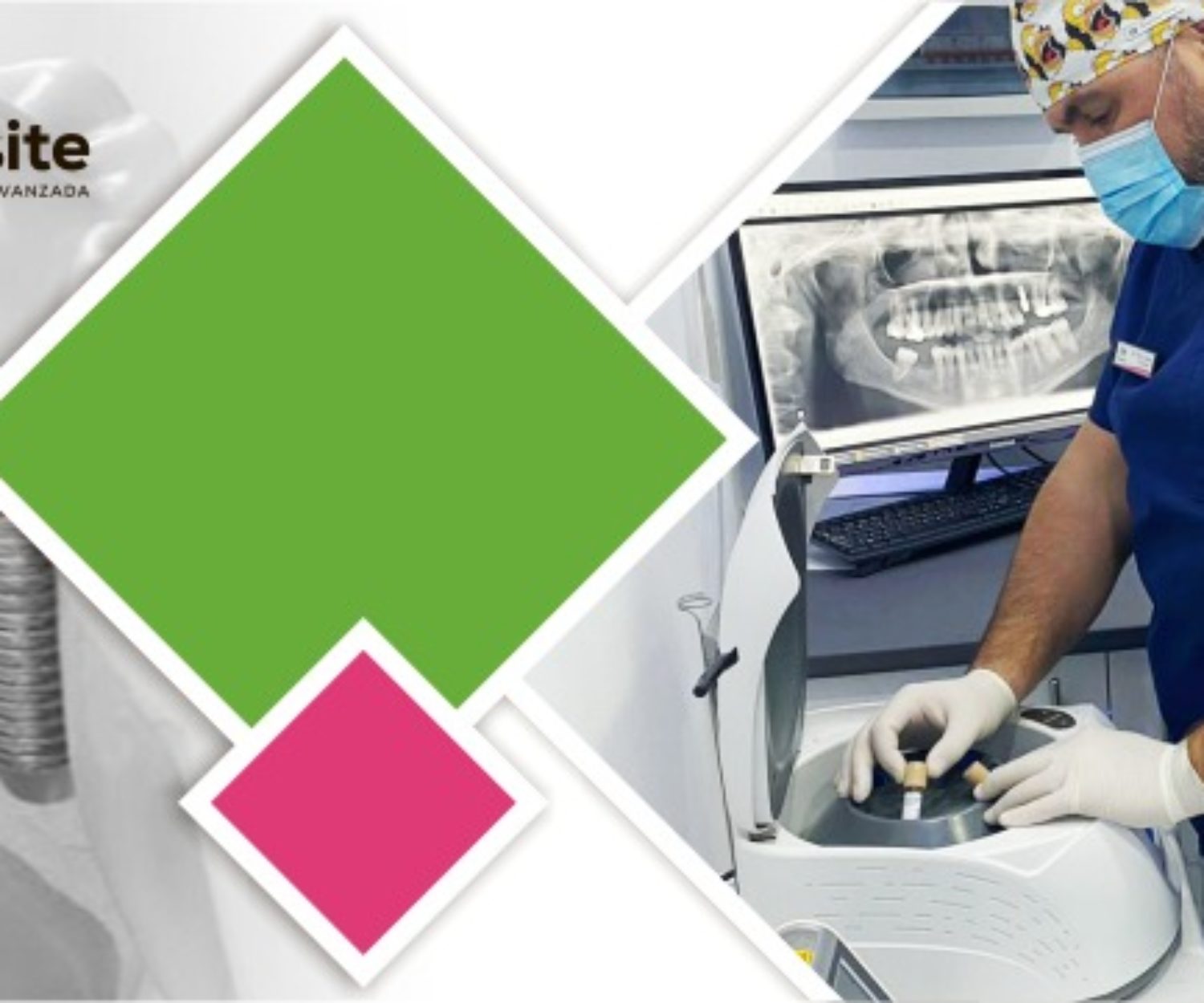 doctor de Clínica Implantsite utilizando la centrifugadora de plasma para la regeneración ósea de un paciente