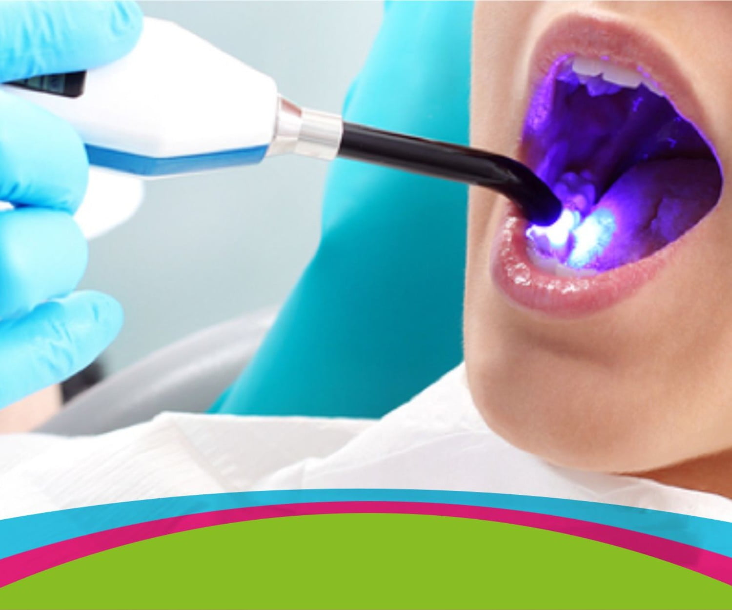 imagen de laser dental