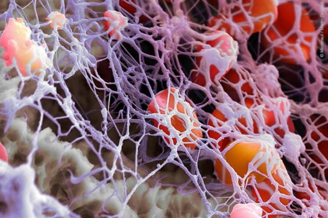 muestra de prf vista en microscopio