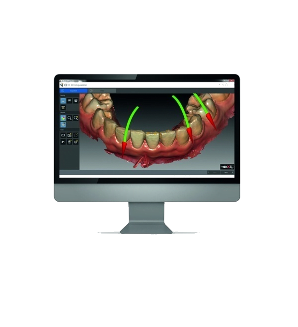 updated 3600 guides feature