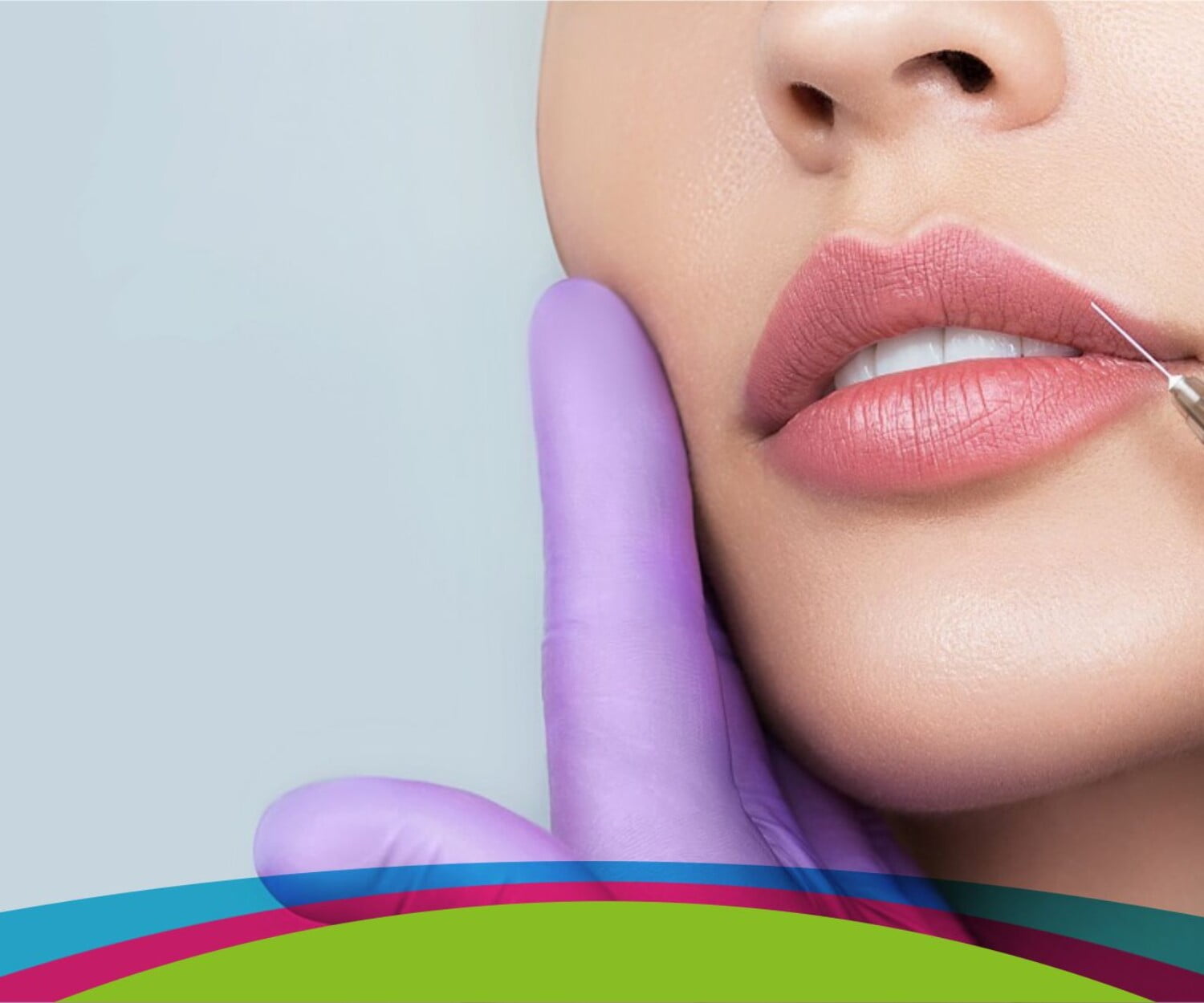 relleno labial con ácido hialurónico