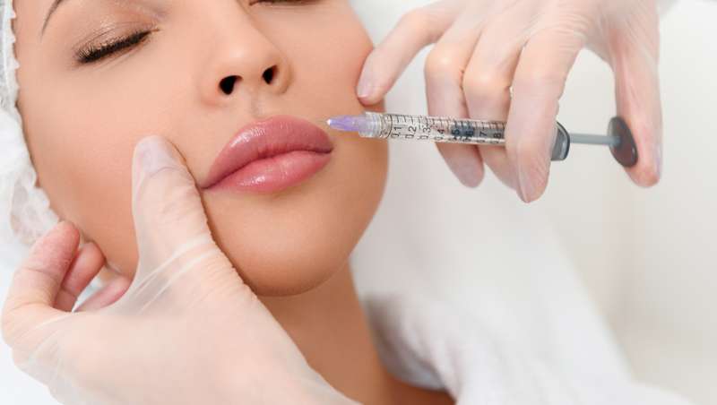 relleno labial con ácido hialurónico