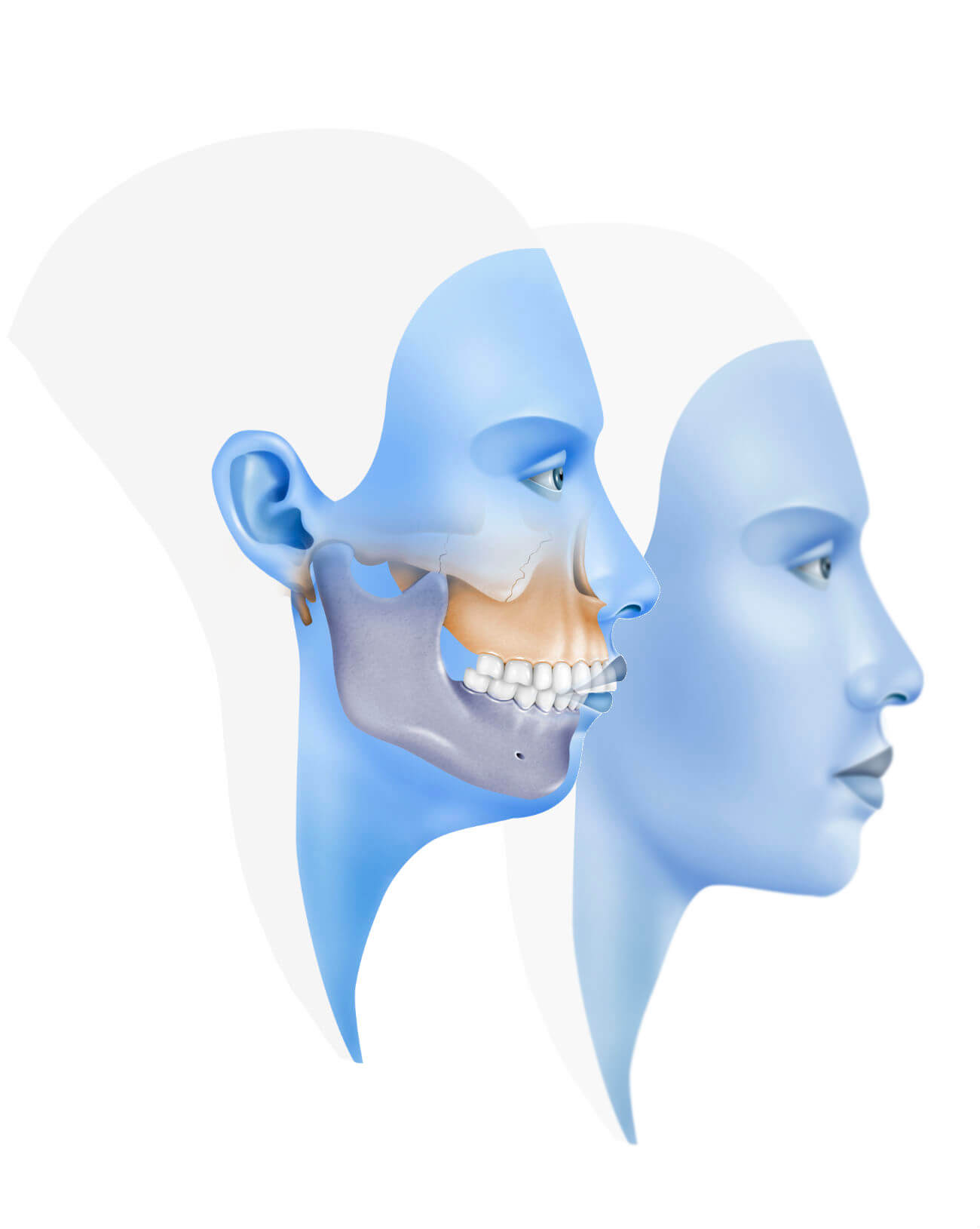 cirugía maxilofacial