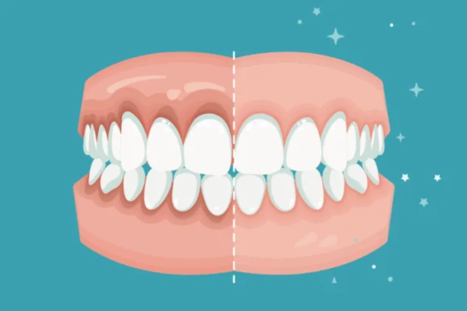 periodoncia conservadora