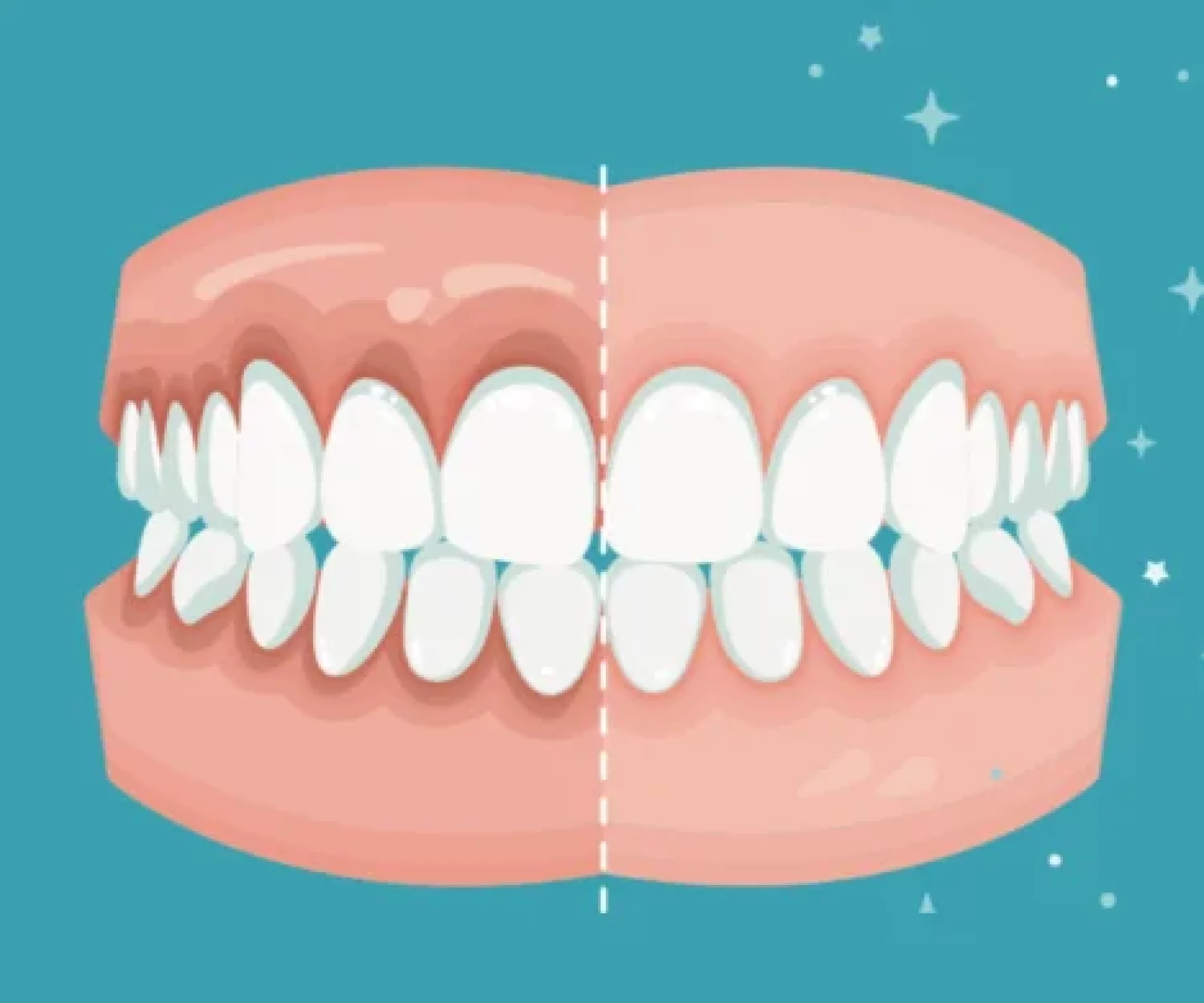 periodoncia conservadora
