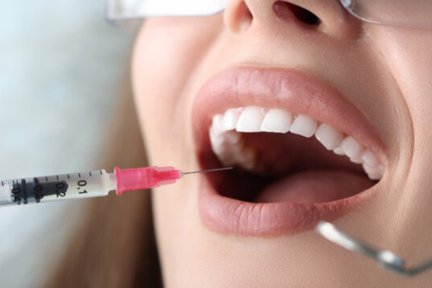 Anestesia dental mujer