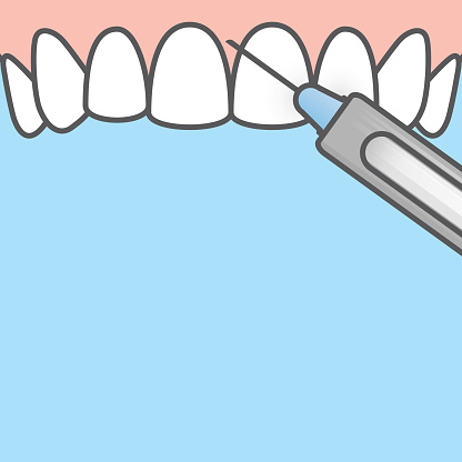 Blank banner Dental anesthesia,a syringe injecting to gums (upper) illustration vector design on blue background. Dental care concept.