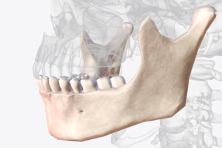 Cirugía Guiada en Implantes Dentales ¿Siempre es necesaria? 4 calidad ósea para cirugía dental
