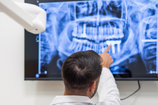 Cirugía Guiada en Implantes Dentales ¿Siempre es necesaria? 6 complicaciones en cirugía invasiva