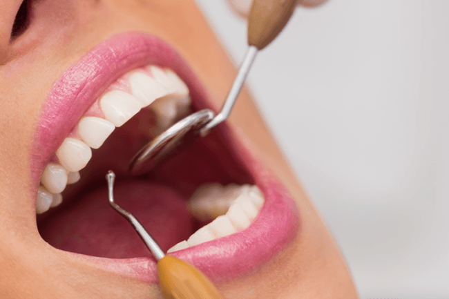tratamiento periodontal 1