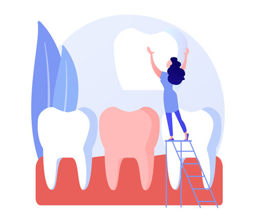 Corona dental para proteger los dientes debilitados por empastes 1 Corona dental para dientes debilitados