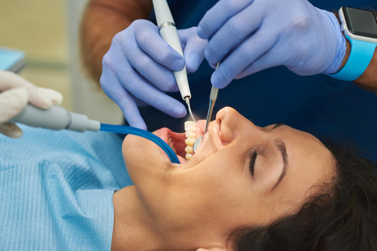 tratamiento periodontal con láser ozono y raspado