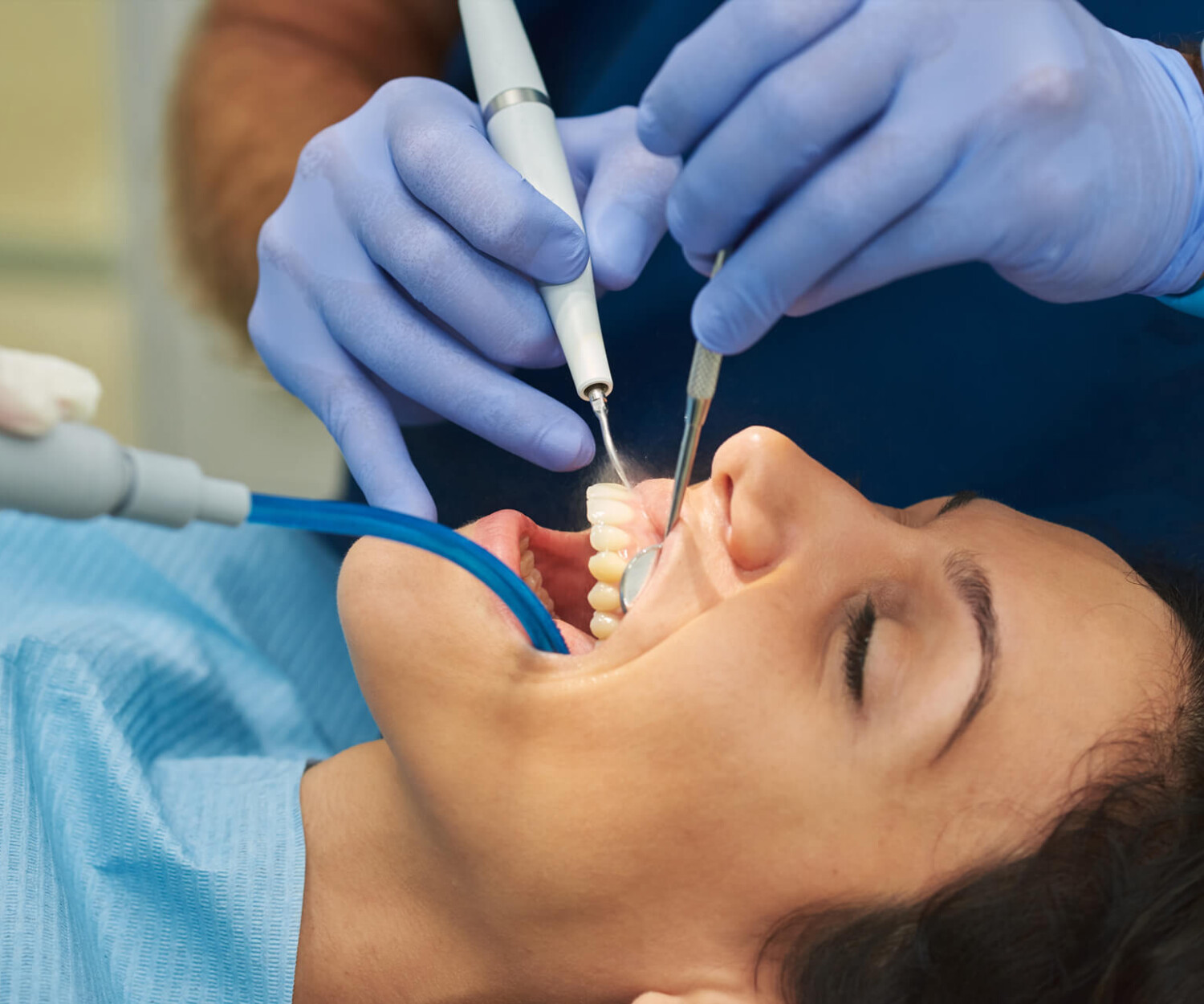 tratamiento periodontal con láser ozono y raspado