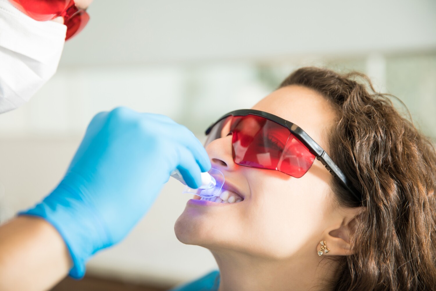 Lo último en blanqueamiento dental profesional