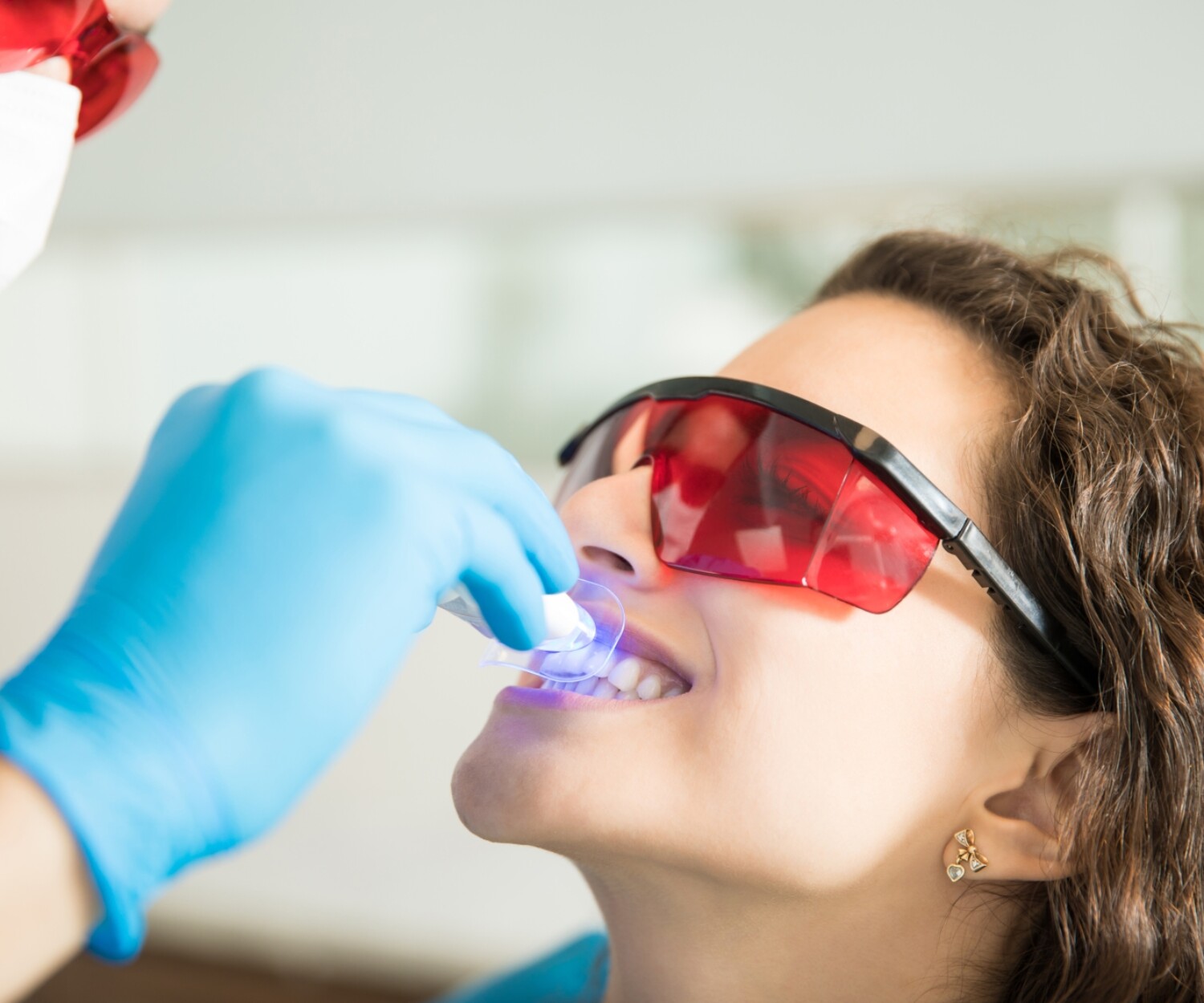 Lo último en blanqueamiento dental profesional