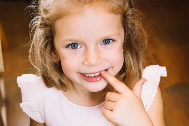 Ortodoncia interceptiva ¿qué es? 1 sonrisa de una niña - ortodoncia interceptiva