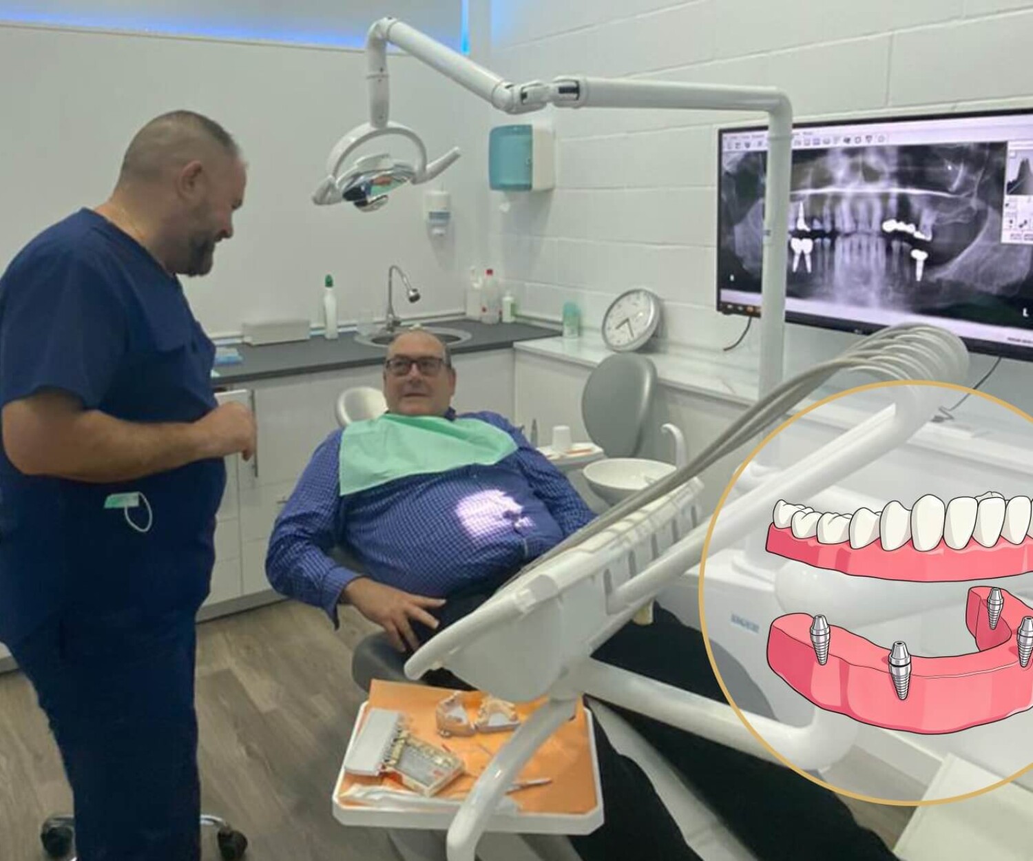 Odontología General en Dos Hermanas 9 sobredentadura sobre cuatro implantes